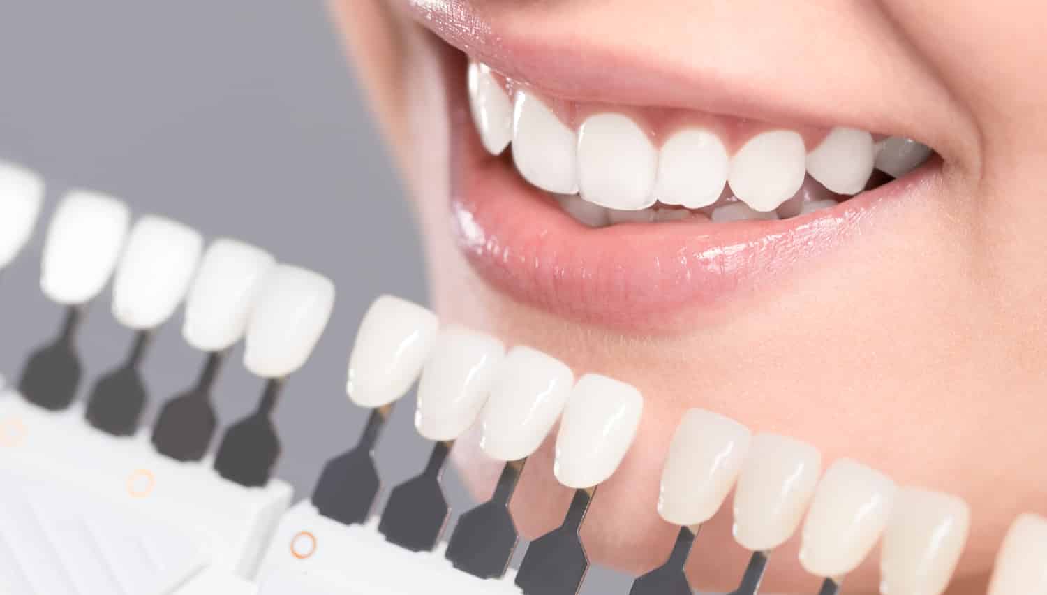 How to Achieve a Brighter Smile with Teeth Whitening