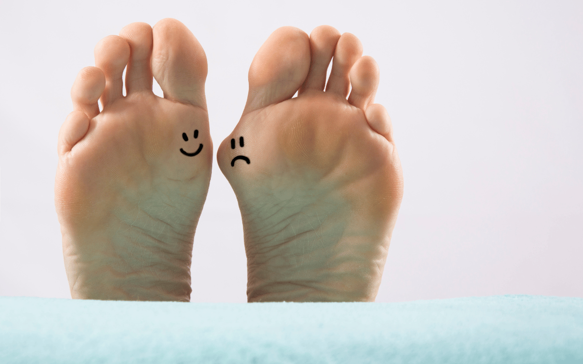 4 Remedies for Bunions