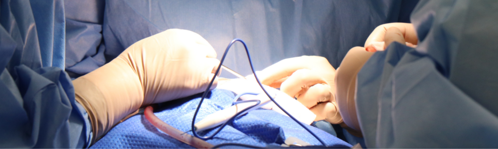 What To Discuss With Your Surgeon Before Gallbladder Surgery