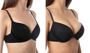 What You Need To Know About Breast Lift Surgery