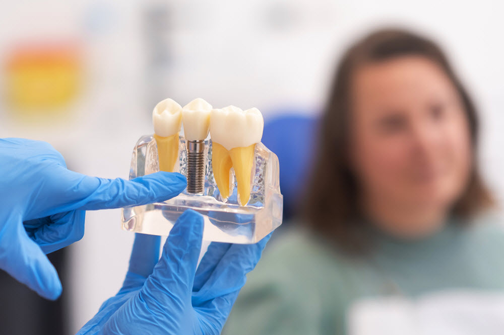 Benefits of Choosing Endodontic Implants Over Traditional Options