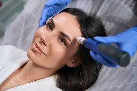 Combining Microneedling With Other Treatments for Maximum Effect