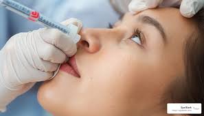 Exploring the Benefits of Botox for Wrinkle Reduction