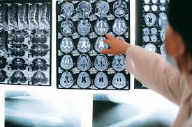 Exploring the Different Types of MRI Scans Available