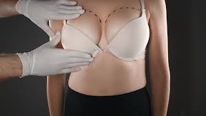 How a Breast Surgeon Determines the Best Surgical Approach