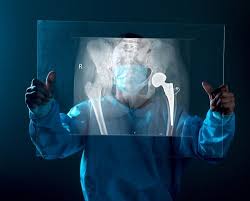 Innovations in Robotic-Assisted Joint Replacement