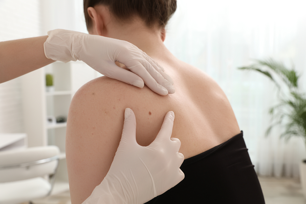 Preparing for Your First Visit to a Dermatologist