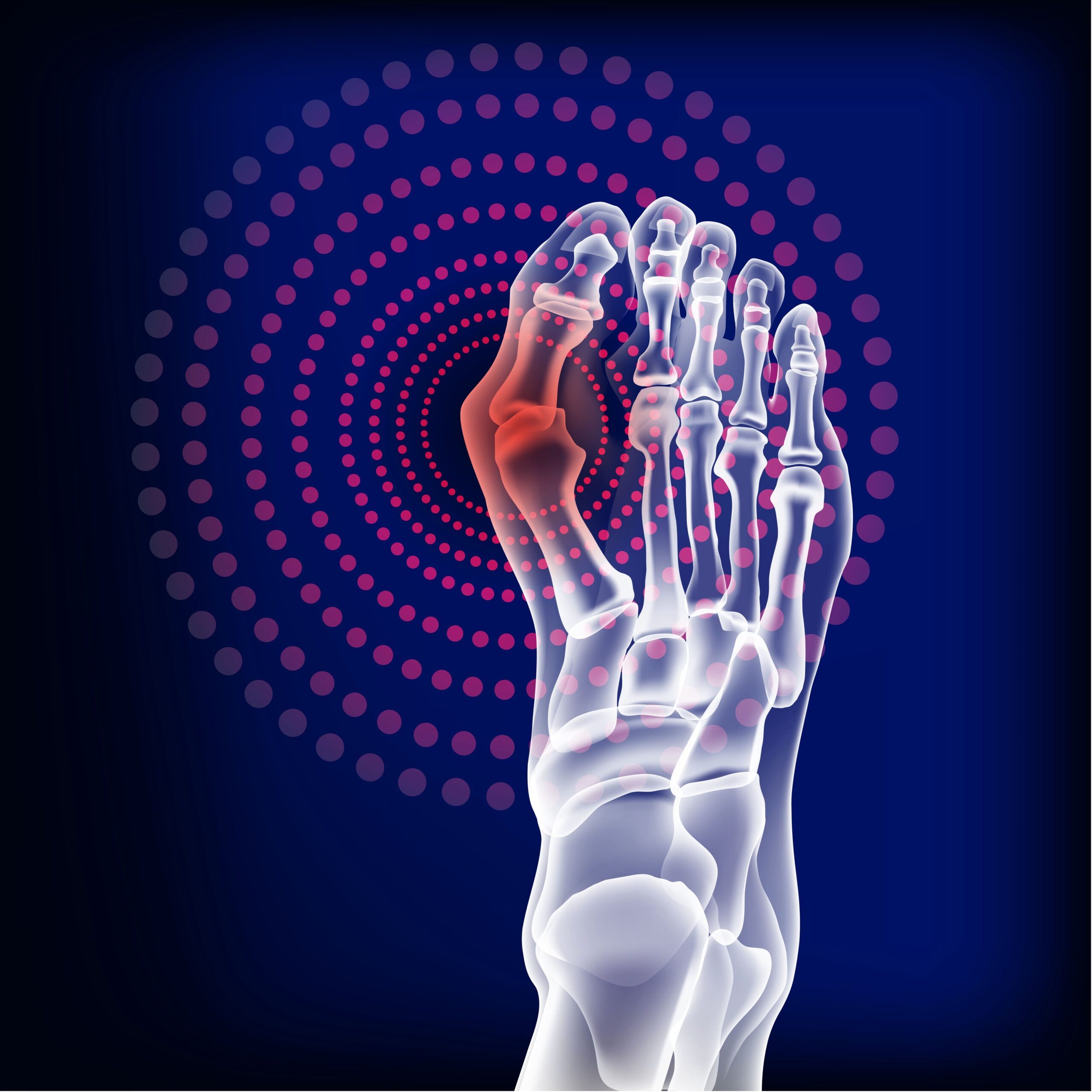 Recognizing the Signs of Arthritis and When to Seek Help from Podiatrist