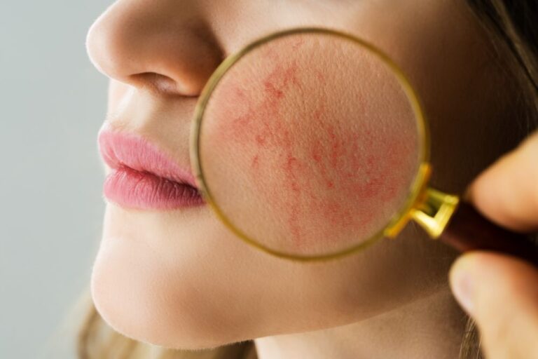 The Dermatologist's Perspective on Identifying Skin Conditions