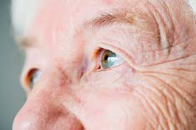 Tips for Coping With a Glaucoma Diagnosis