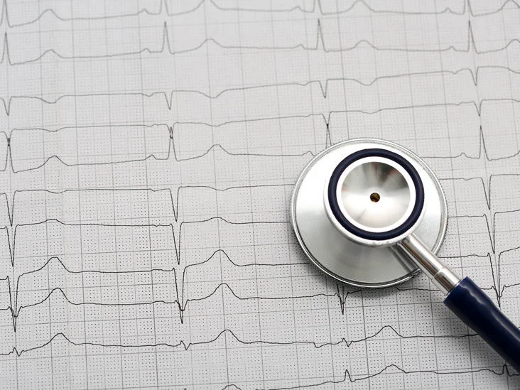 Understanding How an EKG Works