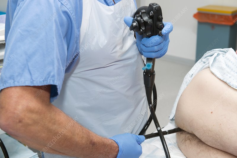 What Happens During a Colonoscopy?